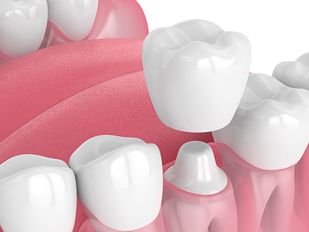 Palos Dental Group